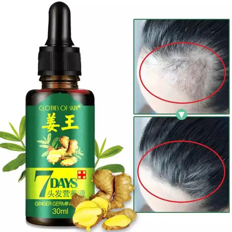 7 Days 100% Hair Growth Serum Oil – Strengthening & Nourishing Hair Oil, 30ml