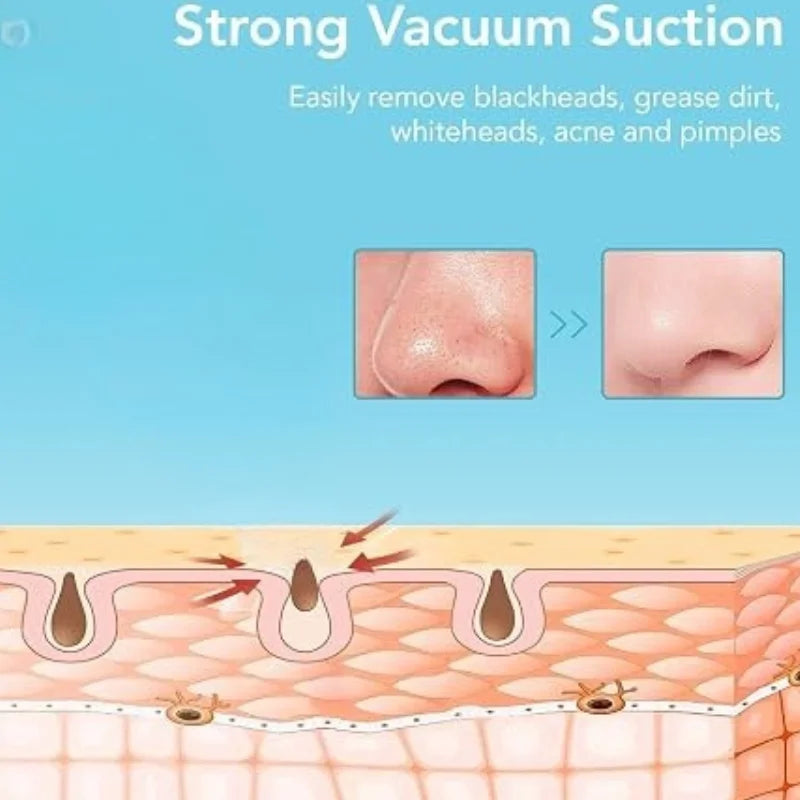 Blackhead Remover Vacuum | FPLS-001 | Deep Pore Cleansing Device